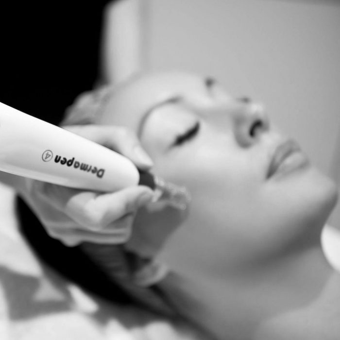 Micro Needling/ Dermapen | Promedic Laser & Skin